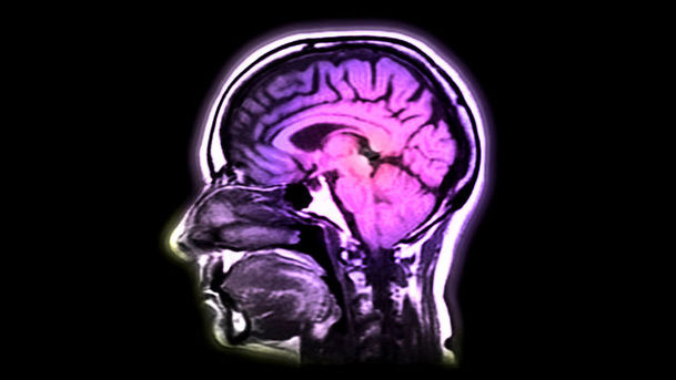 Logo for Hospital - Series 3 - Brain Disorder
